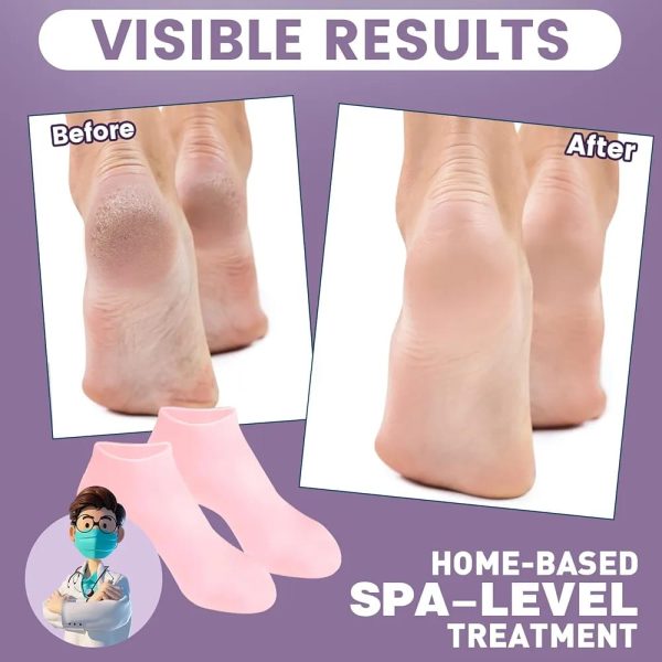 Silicone Socks For Dry and Cracked Feet Heal Treatment