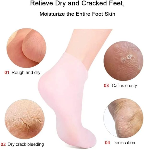 Silicone Socks For Dry and Cracked Feet Heal Treatment