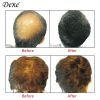 Hair Growth Fiber Powder For Men and Women